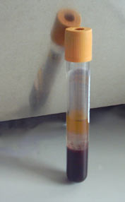 Test Tube