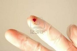 finger puncture image