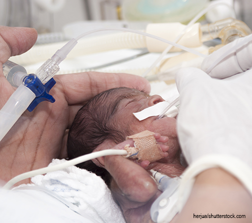 premature infant in incubator getting treatment